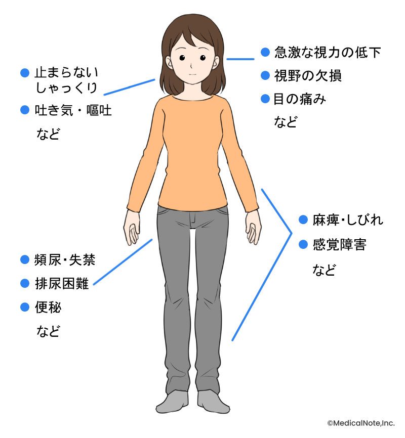 現れる可能性のある症状（MN作成）